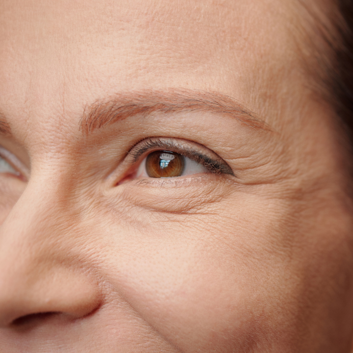 5 Gentle Ways to Minimize Wrinkles